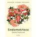 Endometrioza Nie taka Twoja uroda